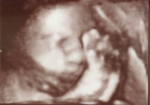 37 tydzien ciąży - zdjęcia 3D