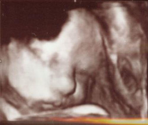 37 tydzien ciąży - zdjęcia 3D